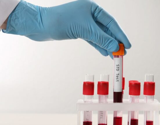std testing