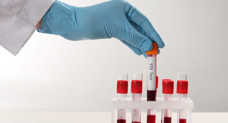 std testing