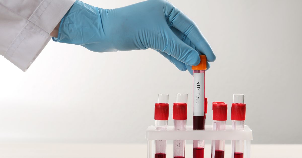 std testing