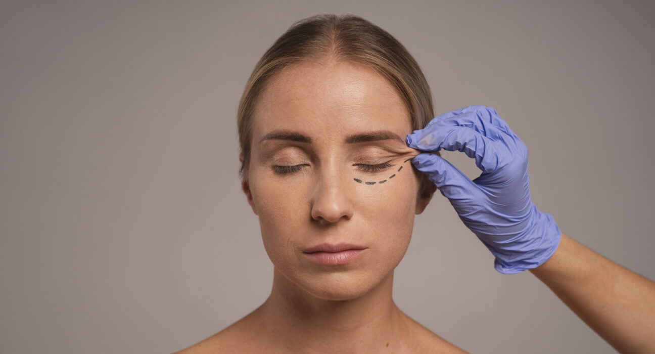 eyelid surgery blepharoplasty