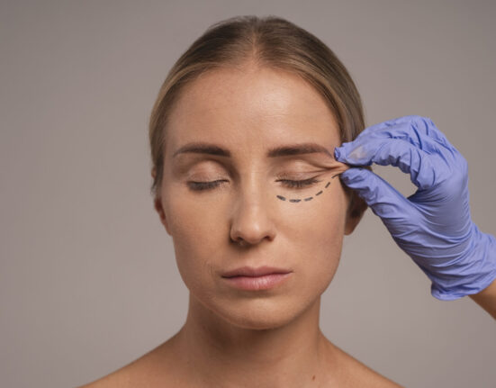eyelid surgery blepharoplasty