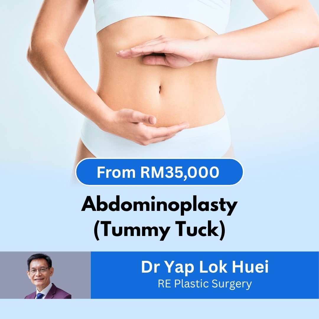 Abdominoplasty - Dr Yap Lok Huei SKU
