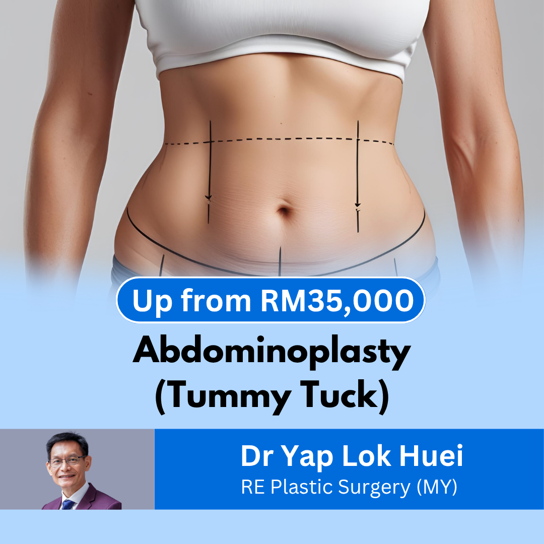 tummy tuck Malaysia