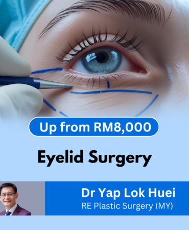 eyelid surgery Malaysia