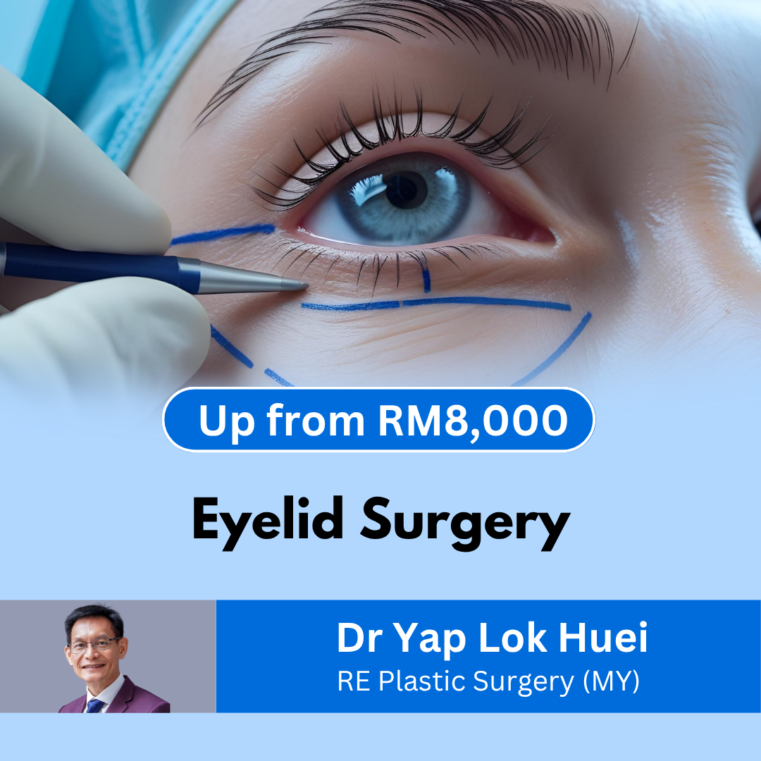 eyelid surgery Malaysia