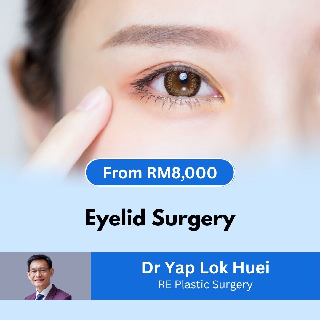 Eyelid Surgery - Dr Yap Lok Huei SKU