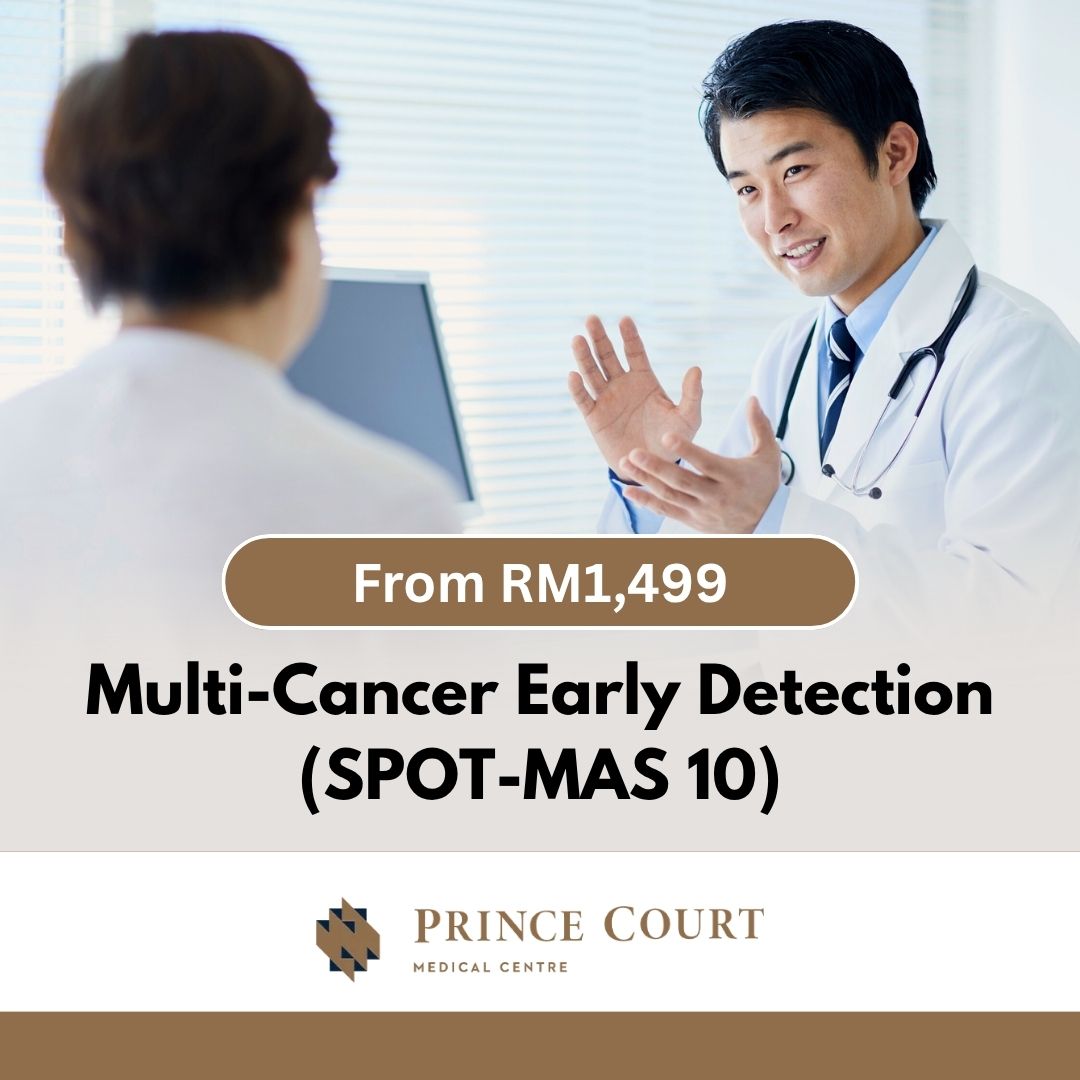 SPOT-MAS 10 - Prince Court SKU