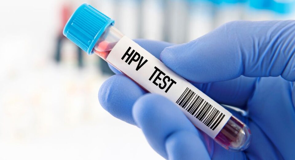 hpv cost