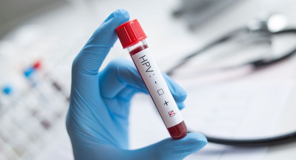 hpv test