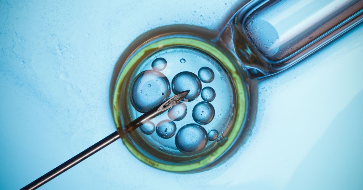 ivf cost