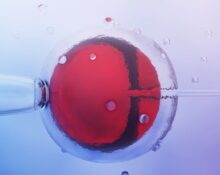 ivf treatment