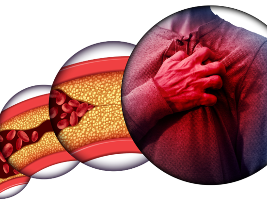 Coronary Heart Disease 1