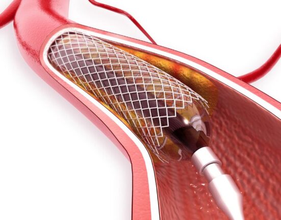 angioplasty cost