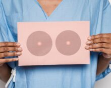 breast surgery singapore
