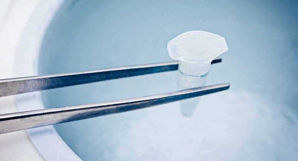 egg freezing in taiwan