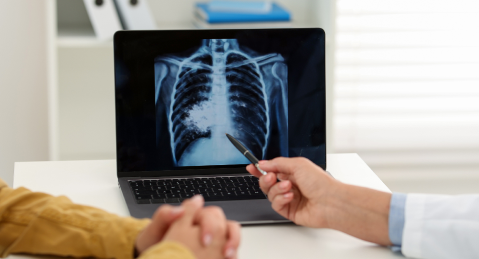 lung cancer screening cost