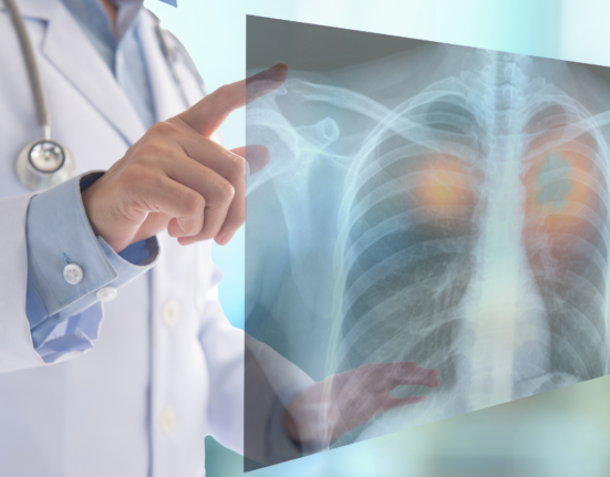 lung cancer singapore