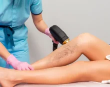 varicose-veins-treatment-singapore-cost