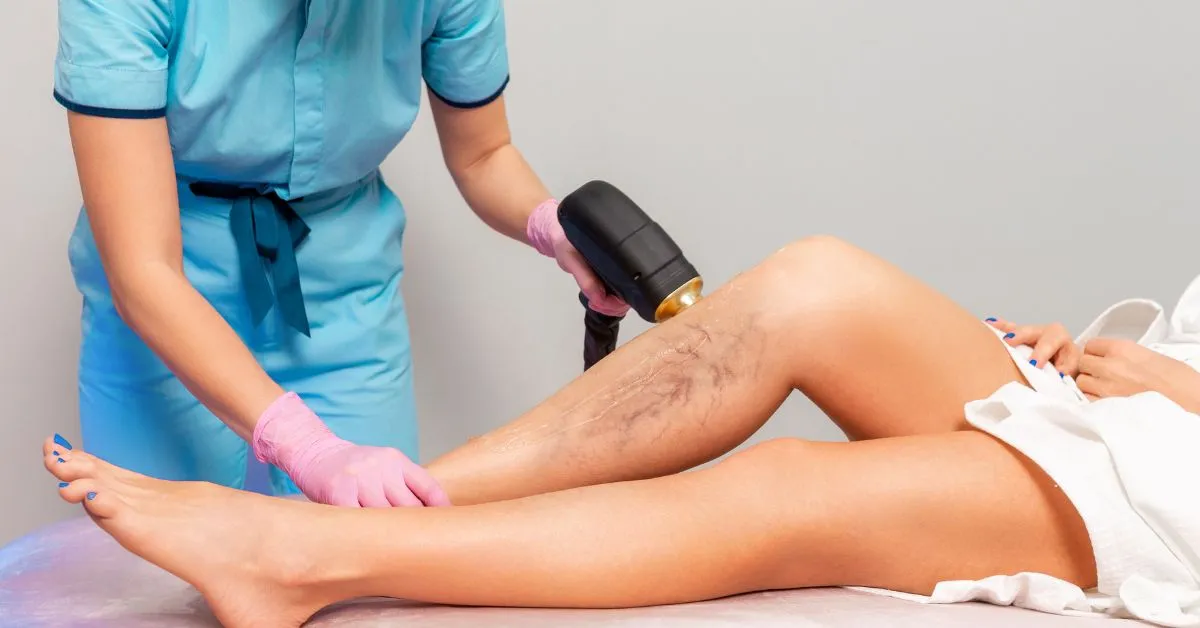 varicose-veins-treatment-singapore-cost