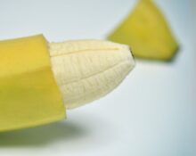 stapler circumcision