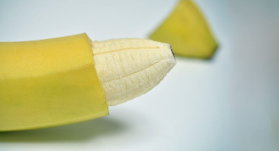 stapler circumcision