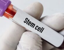 stem cell treatment cost