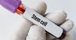 stem cell treatment cost