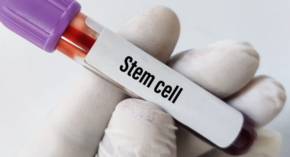 stem cell treatment cost
