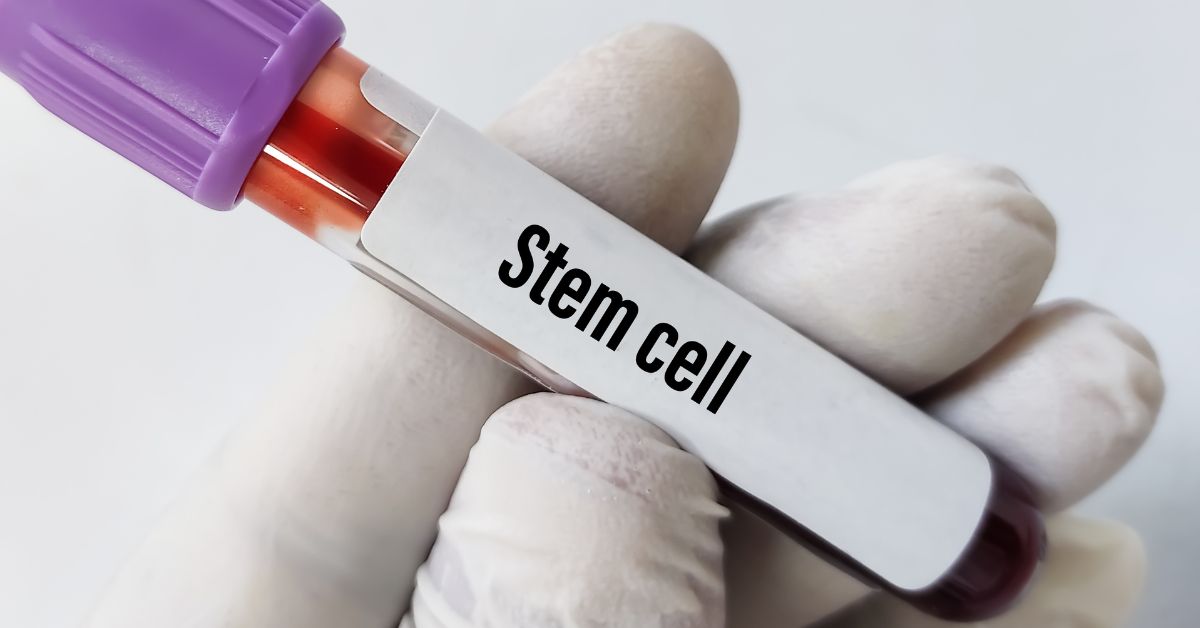 stem cell treatment cost