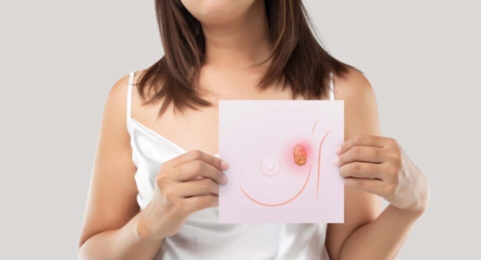 What-is-breast-cancer-singapore