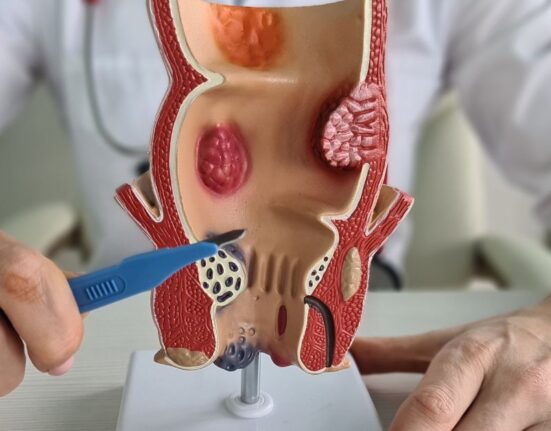 rectal cancer treatment