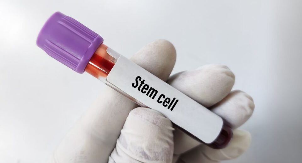 stem cell thailand