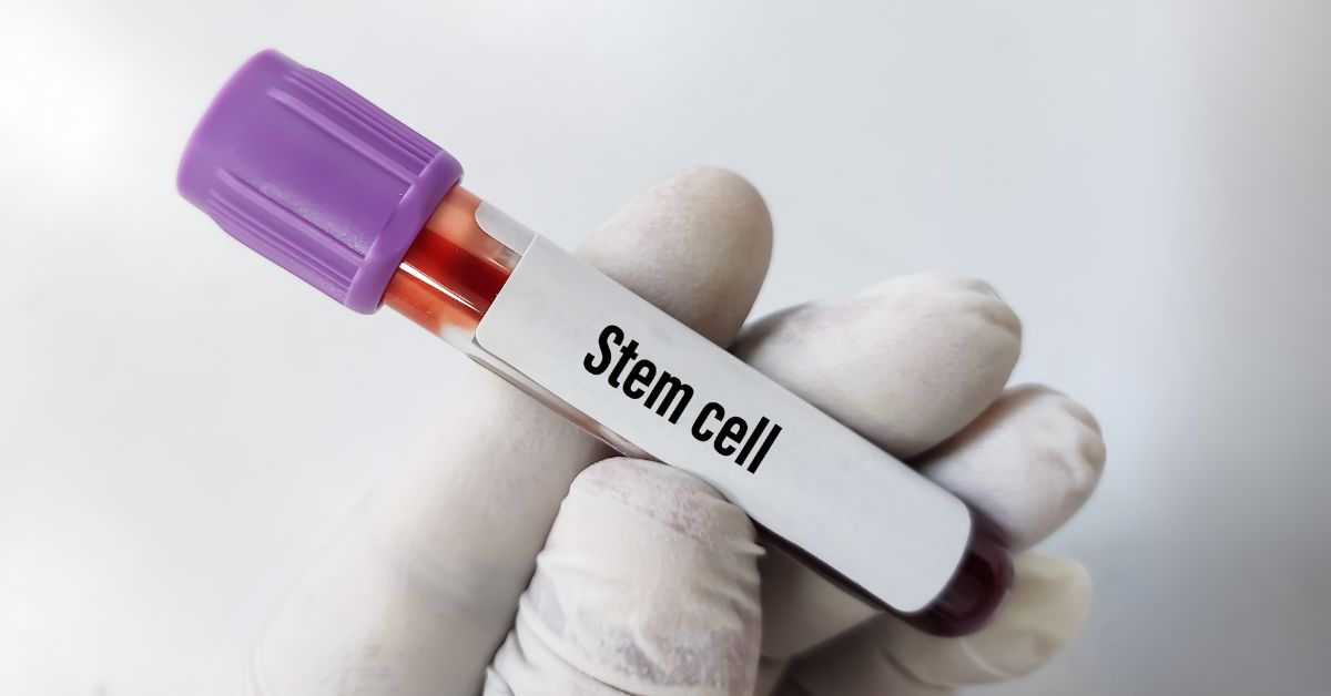 stem cell thailand