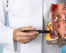 transanal minimally invasive surgery