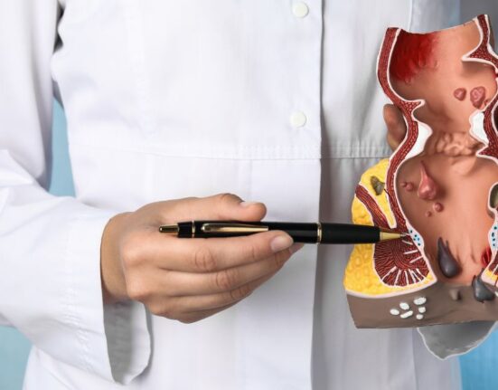 transanal minimally invasive surgery