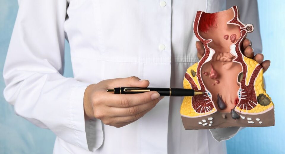 transanal minimally invasive surgery