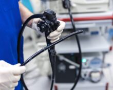 colonoscopy procedure