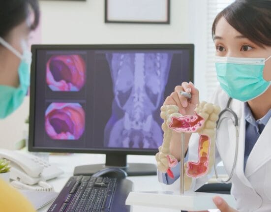 colonoscopy screening