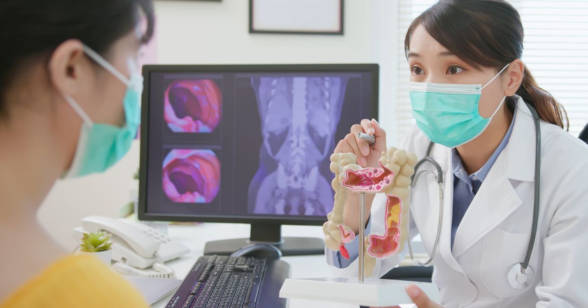 colonoscopy screening