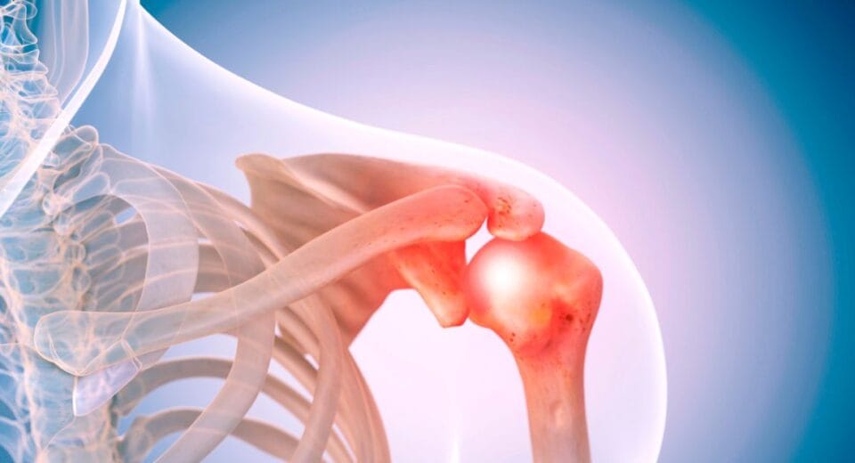 shoulder arthroscopy