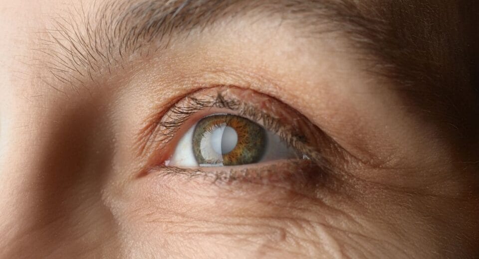 amd eye disease treatment