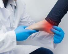ankle arthritis cure