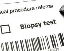 kidney biopsy cost singapore