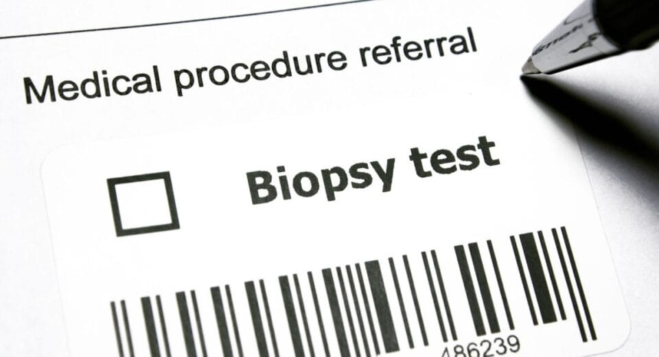 kidney biopsy cost singapore