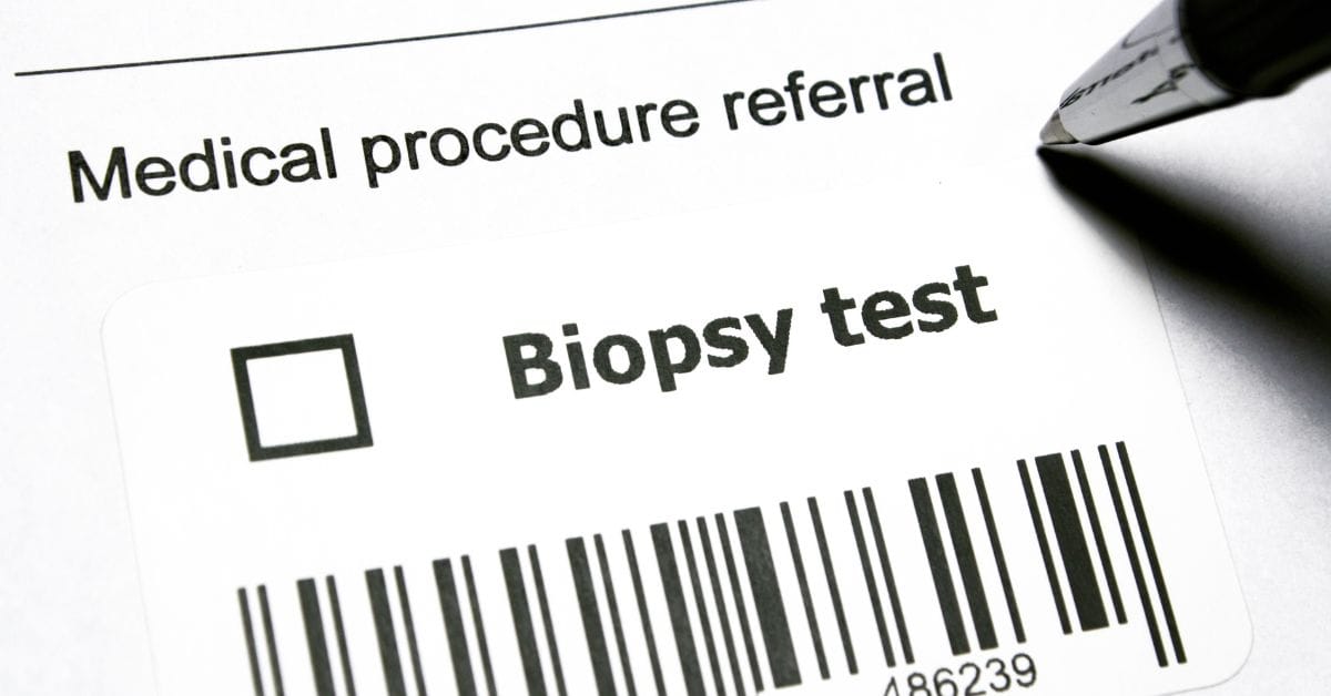kidney biopsy cost singapore