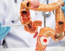 colorectal surgery in singapore