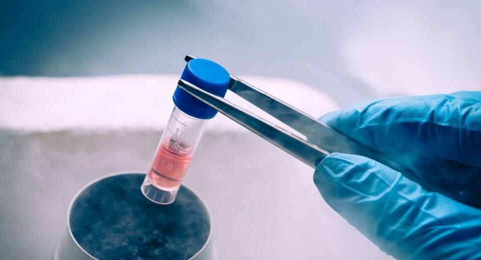 stem cell doctor thailand