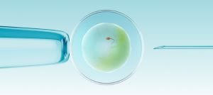 ivf