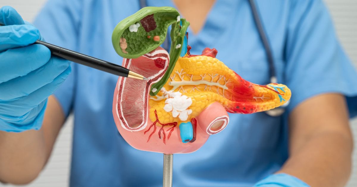 laparoscopic pancreatic surgery