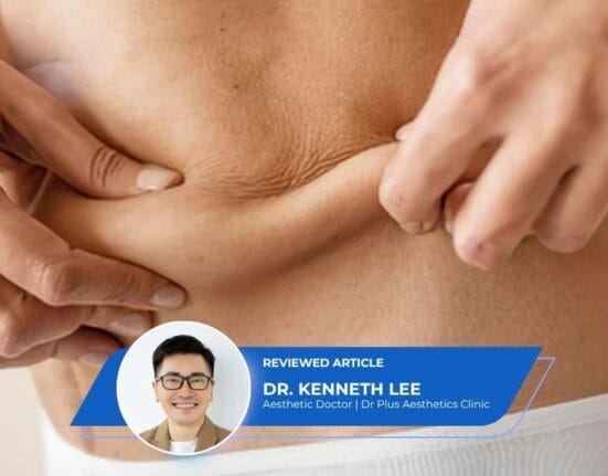 Loose Belly Skin After Pregnancy - Dr Kenneth Lee